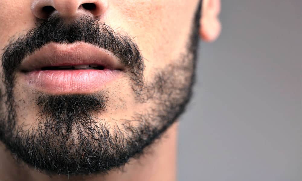 Are There Products To Help With Patchy Beard Growth?