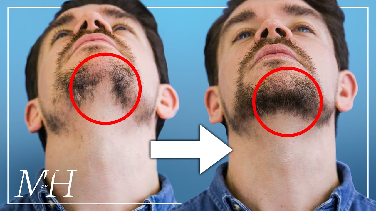 How To Fix A Patchy Beard?