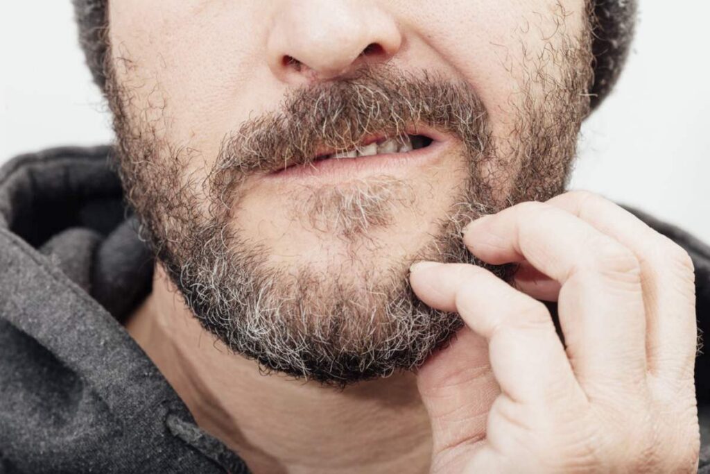 How To Reduce Skin Irritation When Growing A Beard?