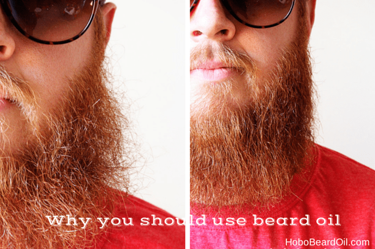 Should I Use Beard Oil