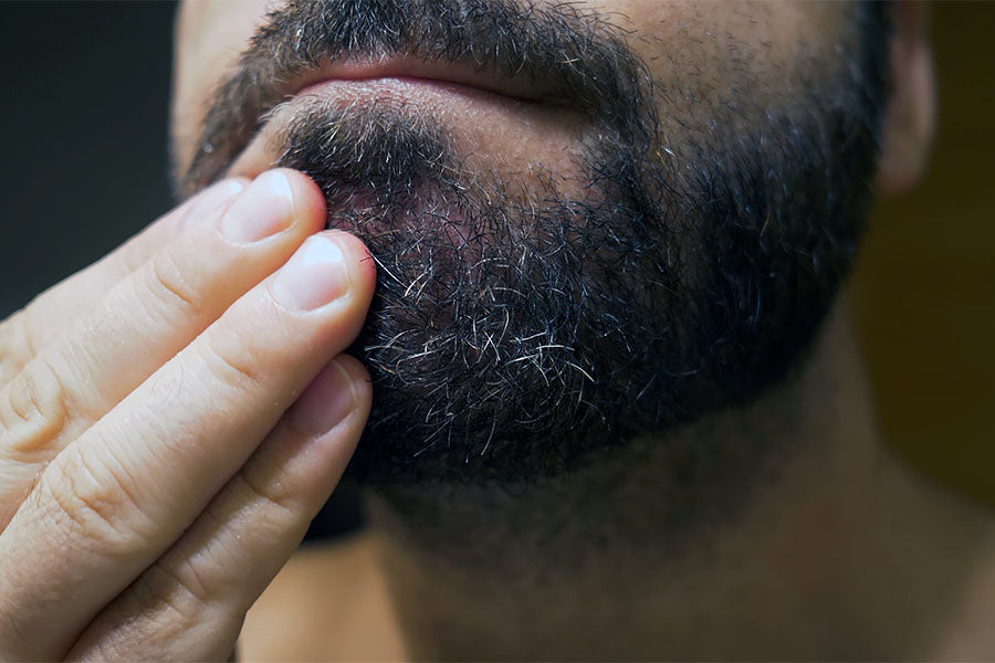 What Causes Beard Dandruff And How Can It Be Treated?