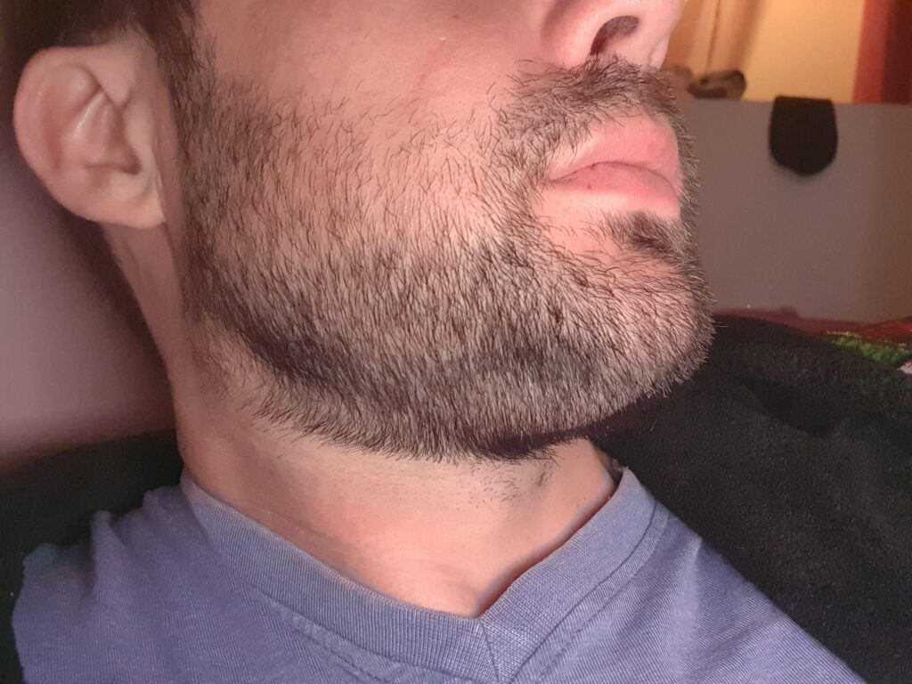 How To Fix A Beard That Grows Sideways?