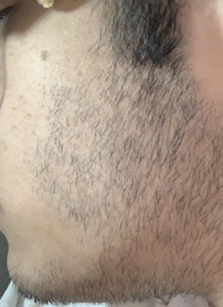 How To Fix A Beard That Grows Sideways?