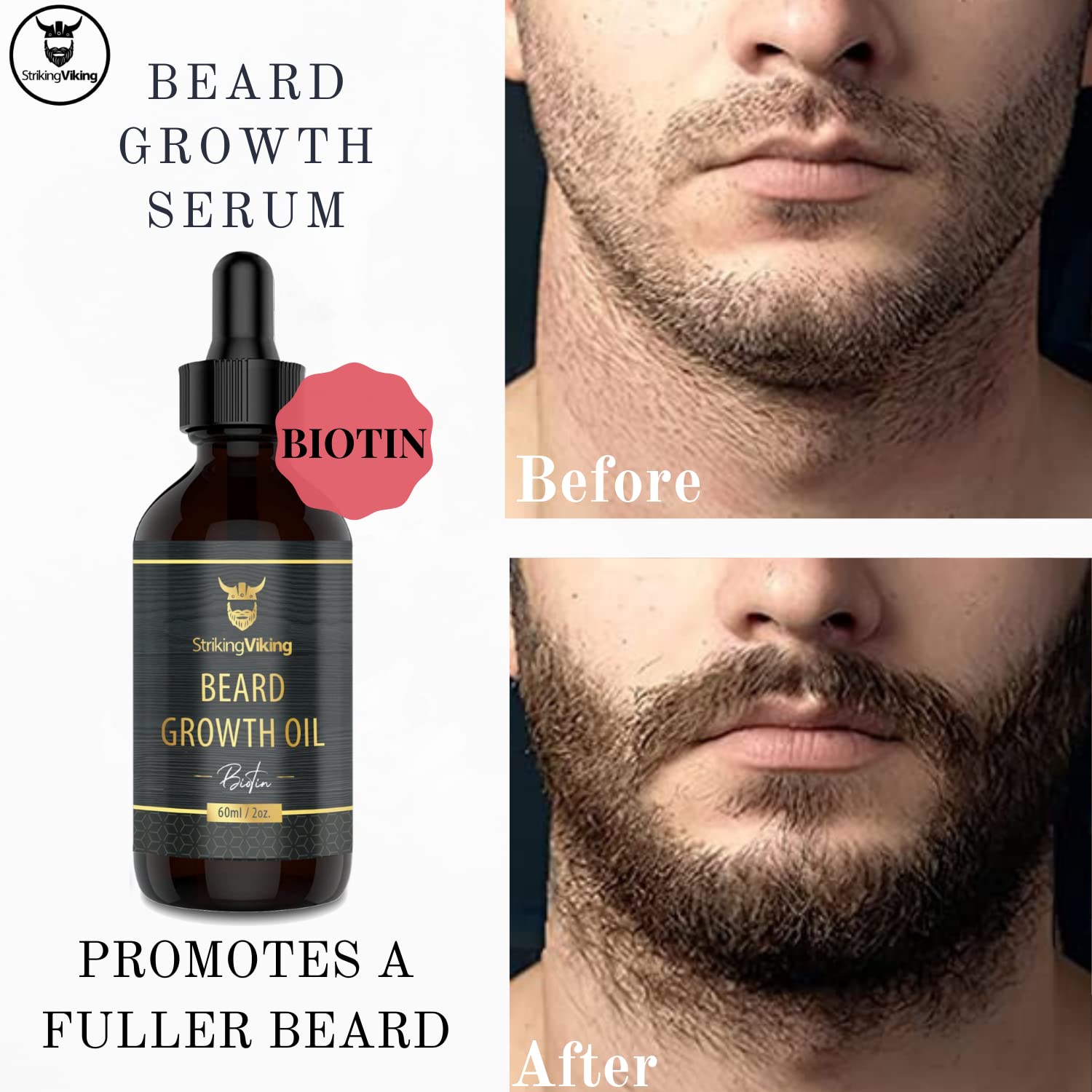 Beard Oil Results Before And After