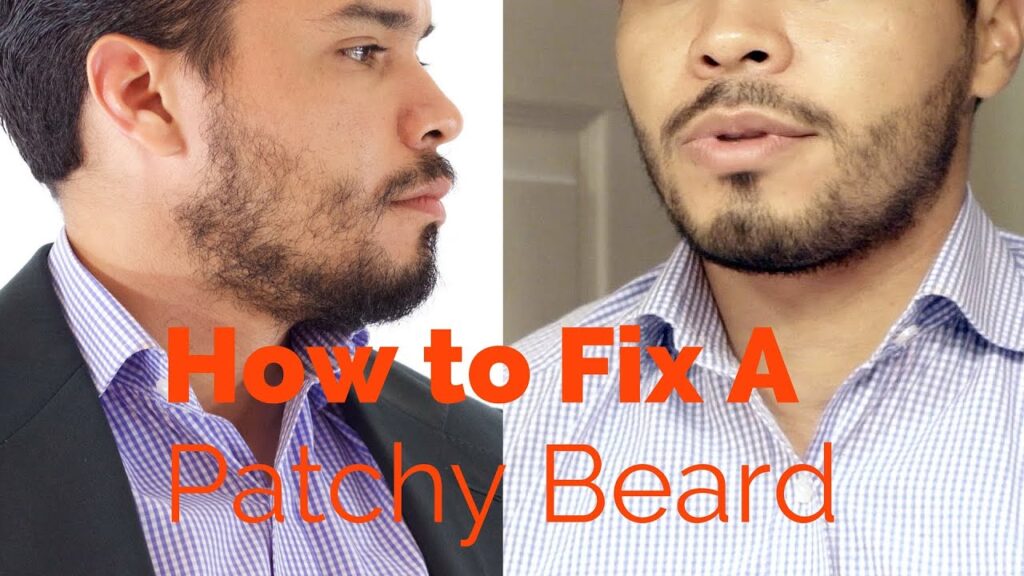 Best Way To Fix Patchy Beard