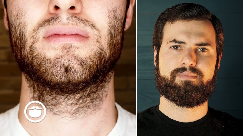 Best Way To Grow Your Beard